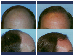 #beforeandafter